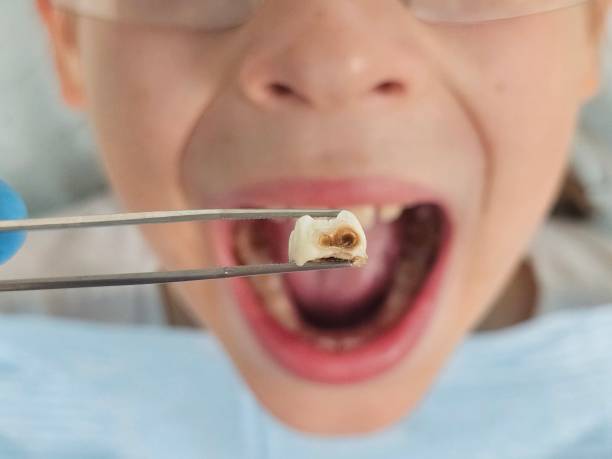 Best Pediatric Emergency Dentist in Perry Heights, OH